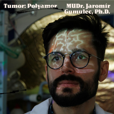 #2 Tumor: Polyamor_Jaromír Gumulec